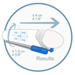 penis-enlargement